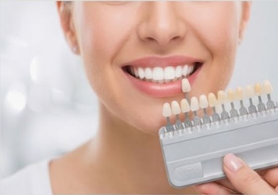 Woman smiling next to a tooth shade guide for whitening